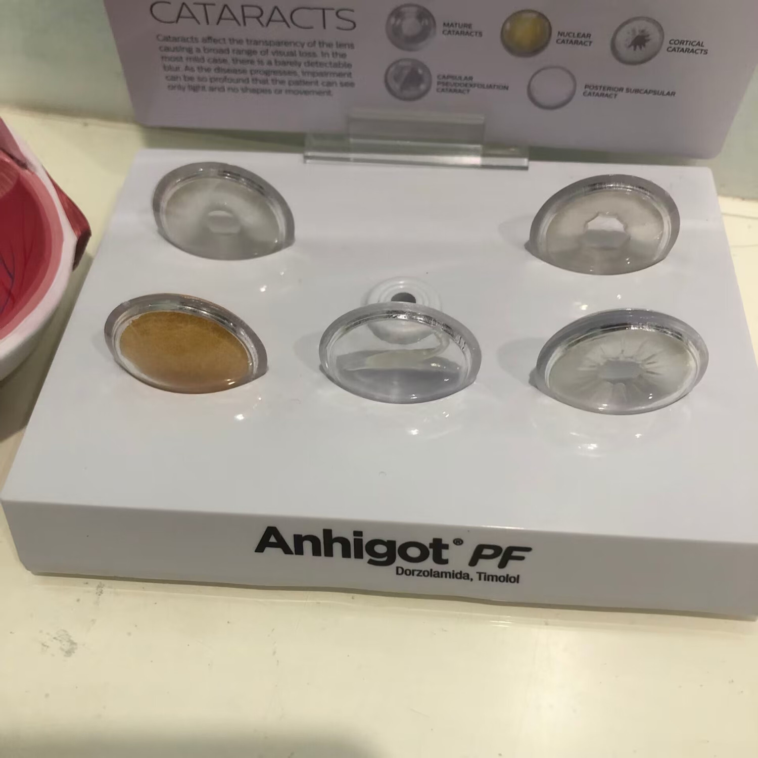 Eye Model Cataract Eye Model,  - Science Exhibition Models recension och pris